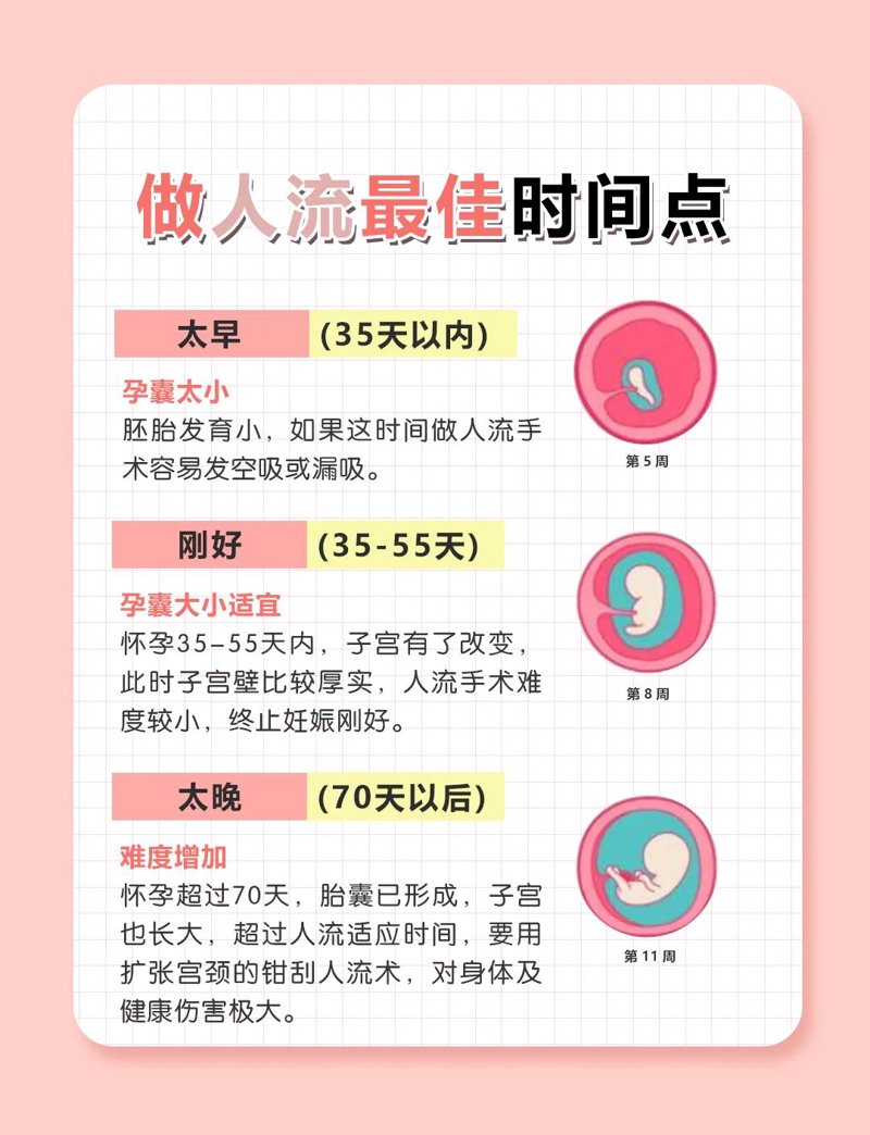 无锡无痛人流：健康与安全并重的选择